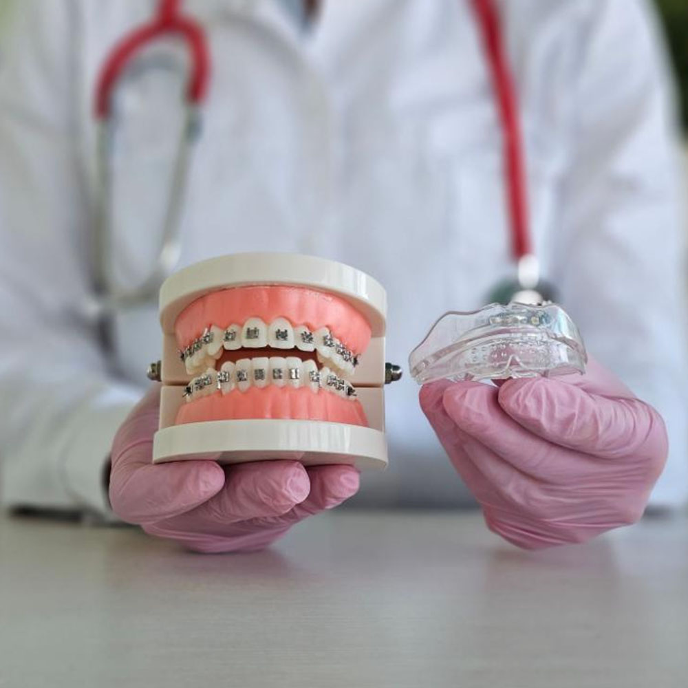 invisalign chewies1.1